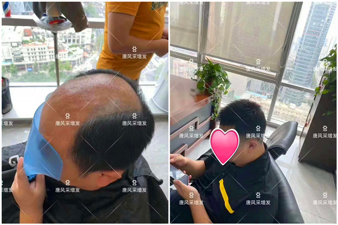 看臉型定做假發(fā) \