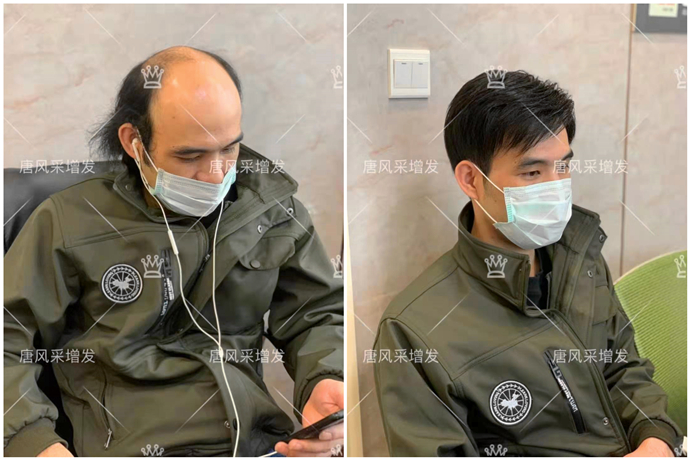 高檔真發(fā)假發(fā) \