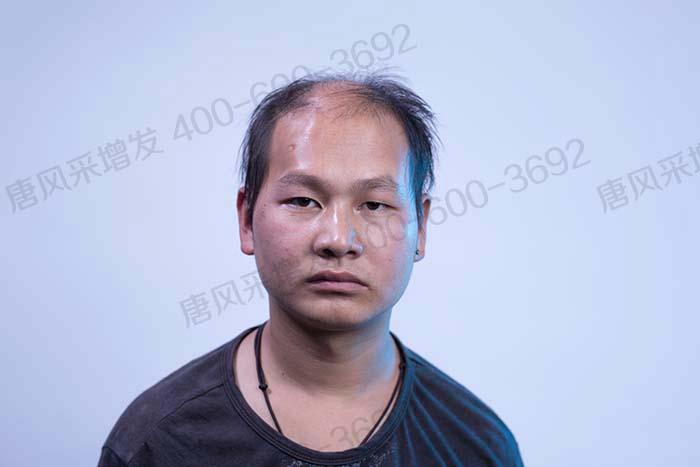 純手工真人發(fā)套的價格, \