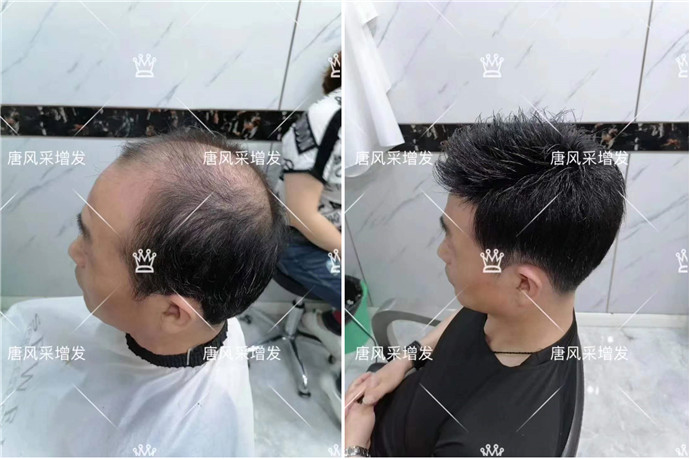 男士假發(fā)會掉嗎 \