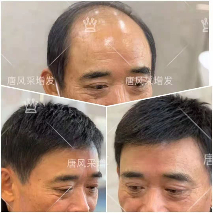 購買假發(fā)需要注意什么 \