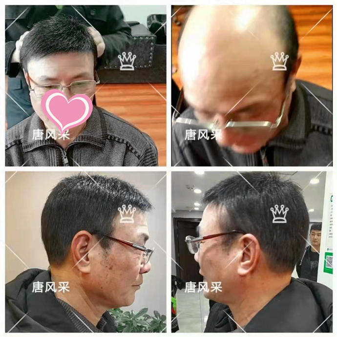 購買假發(fā)需要注意什么 \