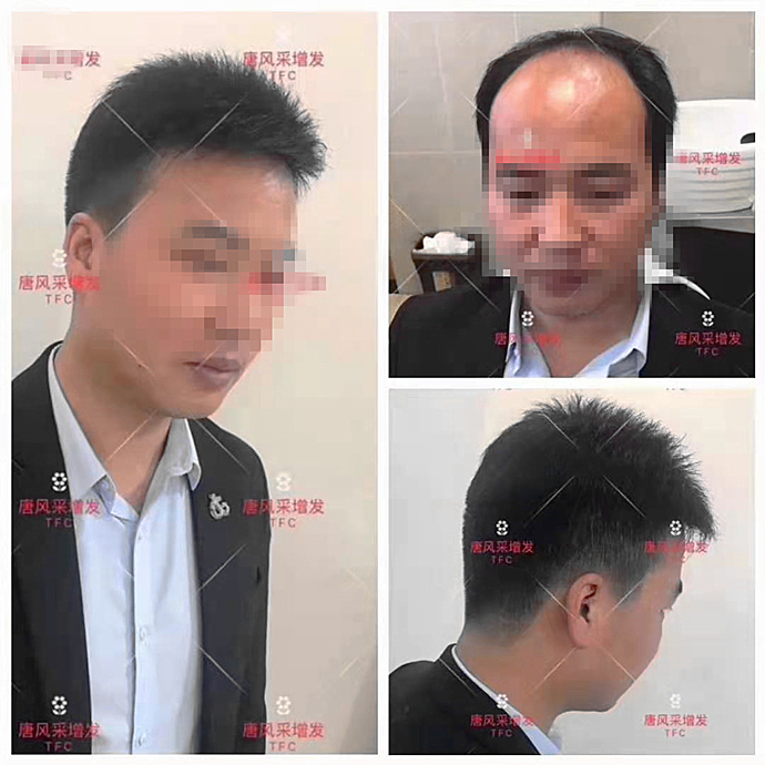 怎樣戴假發(fā)更好看 \