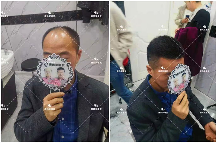 真發(fā)假發(fā)品牌哪家好 \