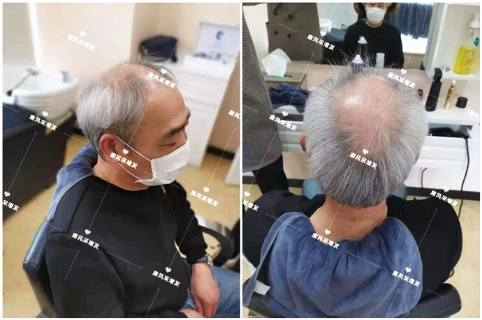 專業(yè)男士假發(fā) \