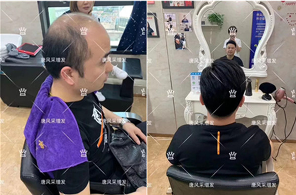 買假發(fā)需要注意哪些 \