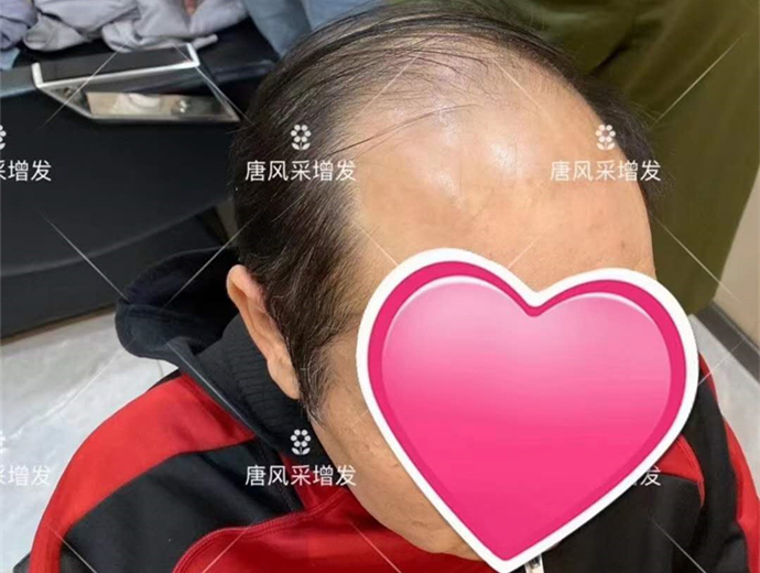 男士潮流假發(fā) \