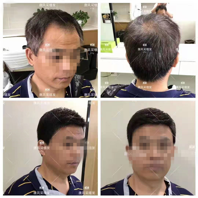 補發(fā)片哪個牌子好 \