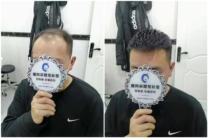 一輩子戴假發(fā) \