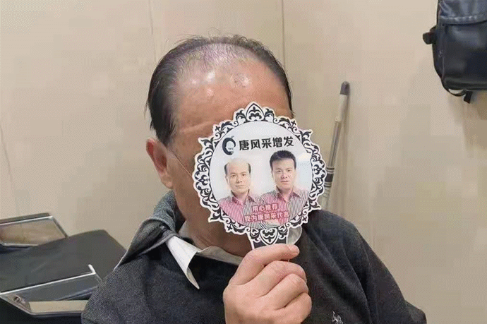 隱形補(bǔ)發(fā) \