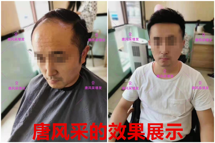 假發(fā)可以戴多久 \