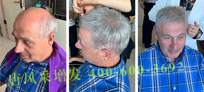 私人訂制無痕補發(fā) \