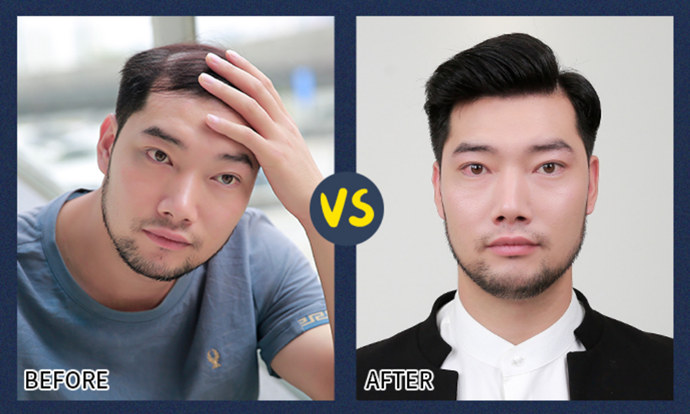 私人訂制無痕補發(fā) \