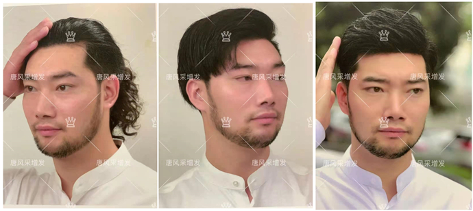 私人訂制無痕補發(fā) \