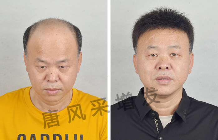 真人假發(fā)品牌哪個好 \