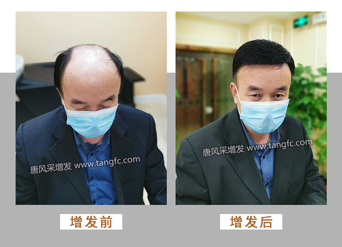 真人假發(fā)品牌哪個好 \