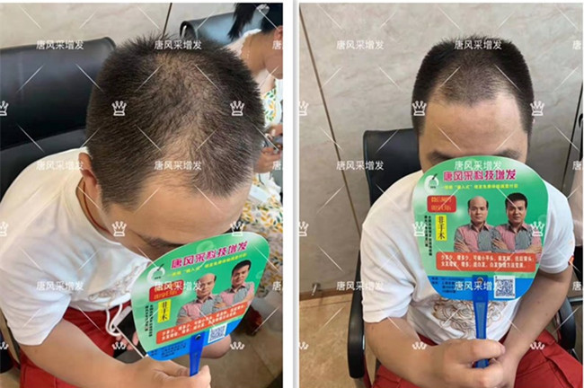 真人假發(fā)品牌哪個好 \