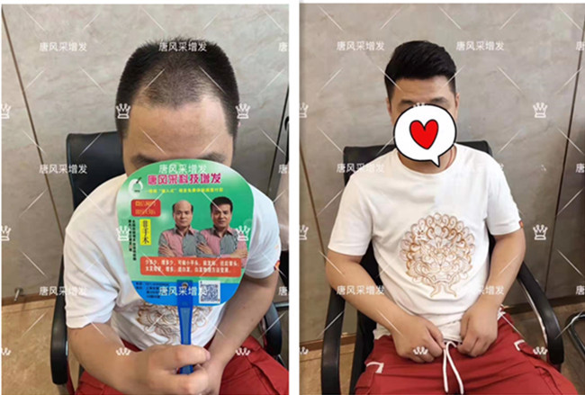 真人假發(fā)品牌哪個好 \