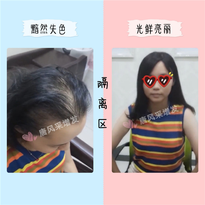 高端假發(fā)定制 \