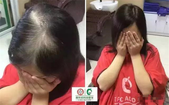 假發(fā)定制多少錢 \