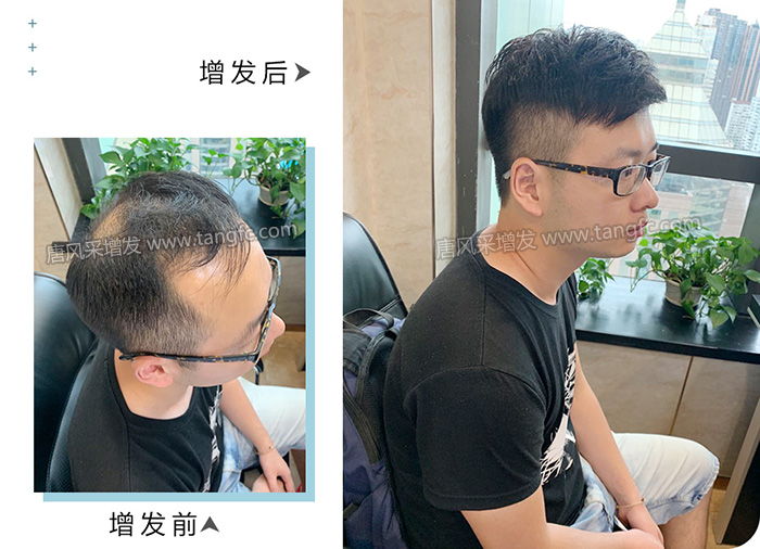 逼真男性假發(fā)片 \