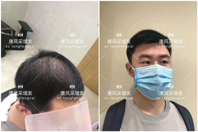 逼真男性假發(fā)片 \