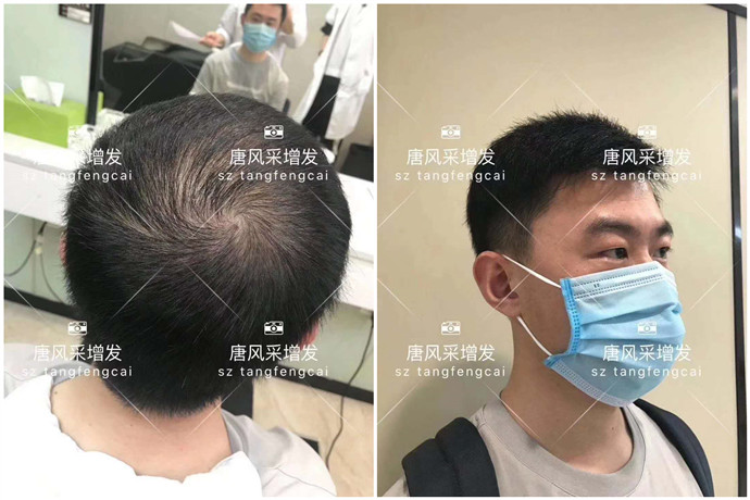 逼真男性假發(fā)片 \