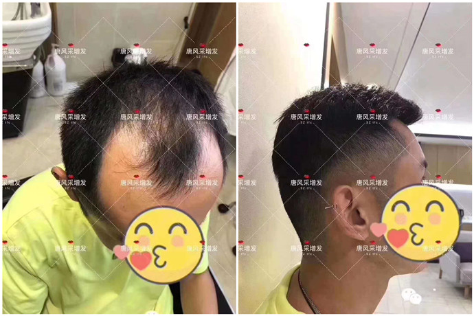 平頭的假發(fā) \