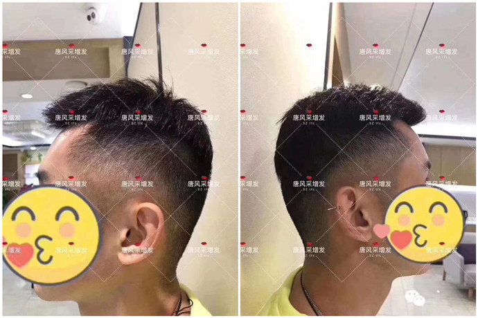 平頭的假發(fā) \