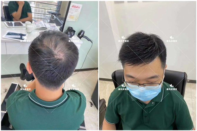 男士小平頭假發(fā) \