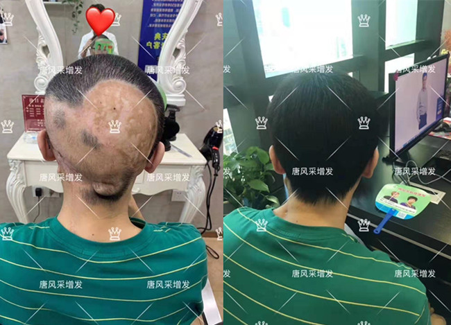 仿真男士假發(fā) \