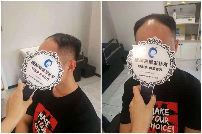 男士假發(fā)發(fā)塊 \