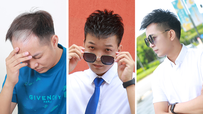 以發(fā)補(bǔ)發(fā) \