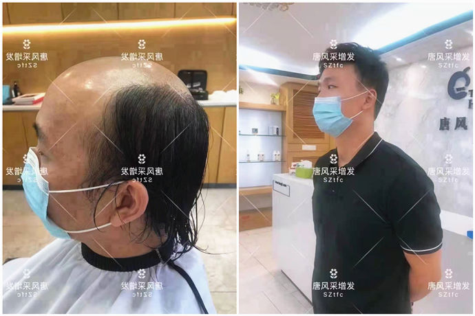 以發(fā)補(bǔ)發(fā) \