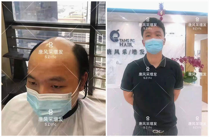 網(wǎng)上男士假發(fā)塊哪家好 \