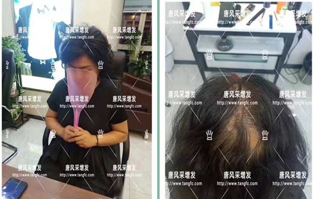 女士梨花假發(fā)多少錢 \