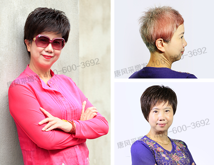 禿頂戴假發(fā)方便嗎 \