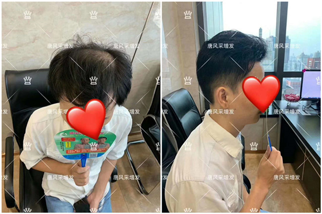 真發(fā)假發(fā)佩戴最逼真 \