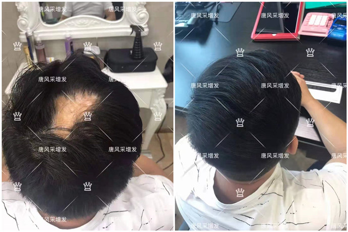 男士真發(fā)假發(fā)套 \