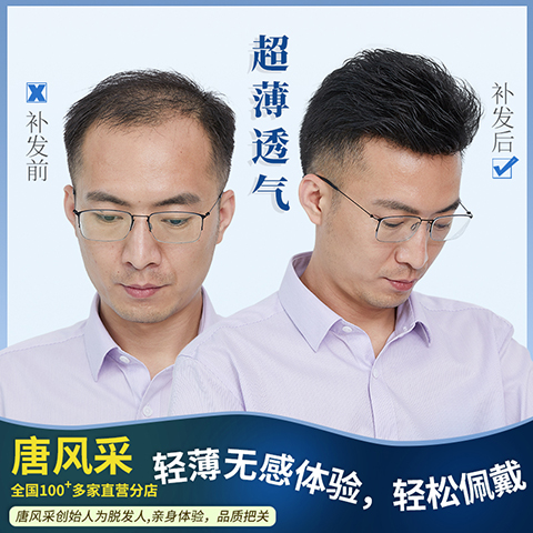 隱形男士補發(fā)塊 \