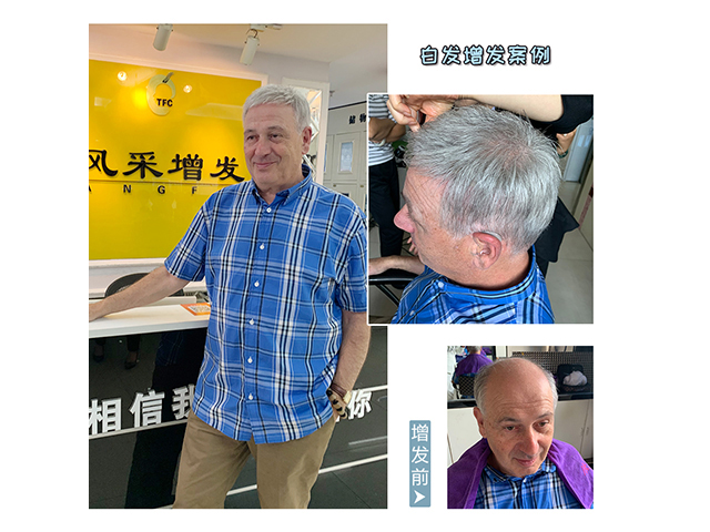 蓋頭頂男士假發(fā)片 \