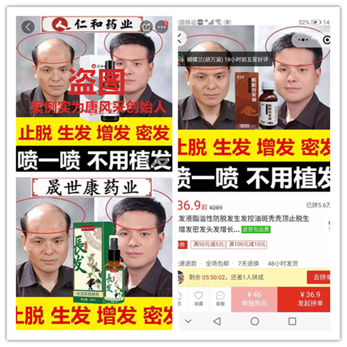 生發(fā)產(chǎn)品 \