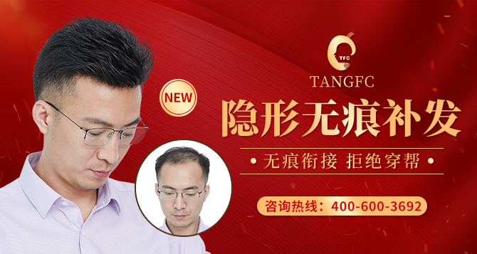 生發(fā)產(chǎn)品 \