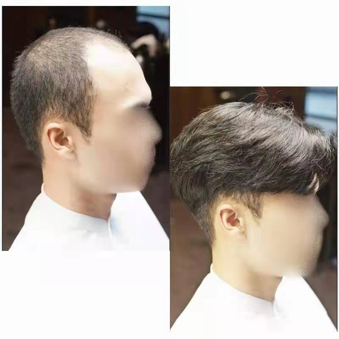 隱形增發(fā)對比照 \