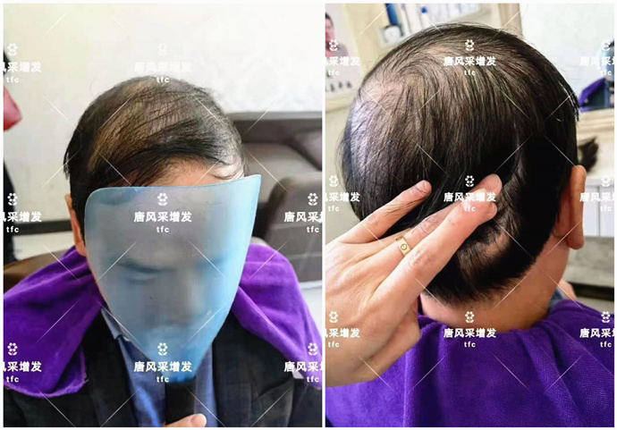 手工定做假發(fā) \