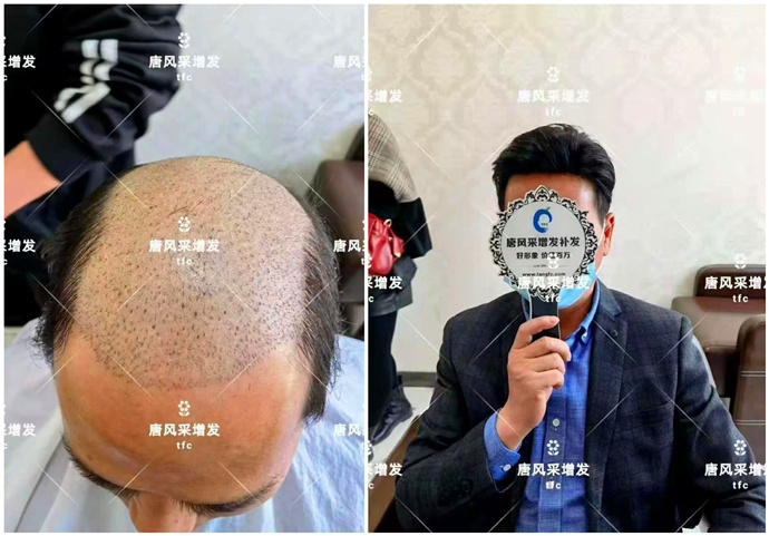 手工定做假發(fā) \