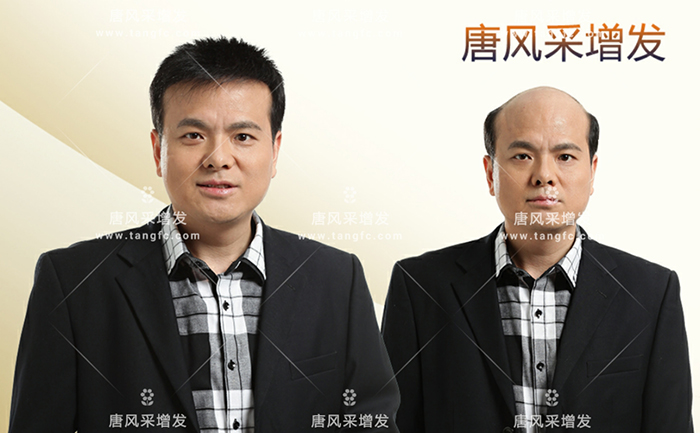 2000元買定制假發(fā) \