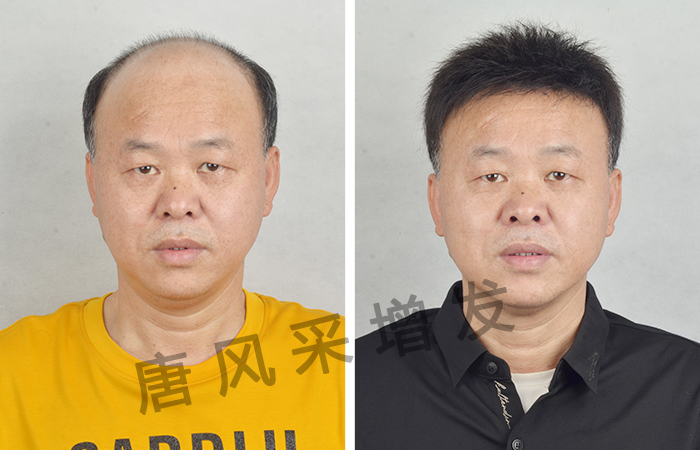 2000元買定制假發(fā) \