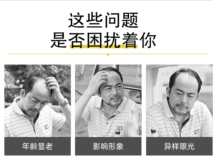 蓋頭頂粘貼假發(fā) \