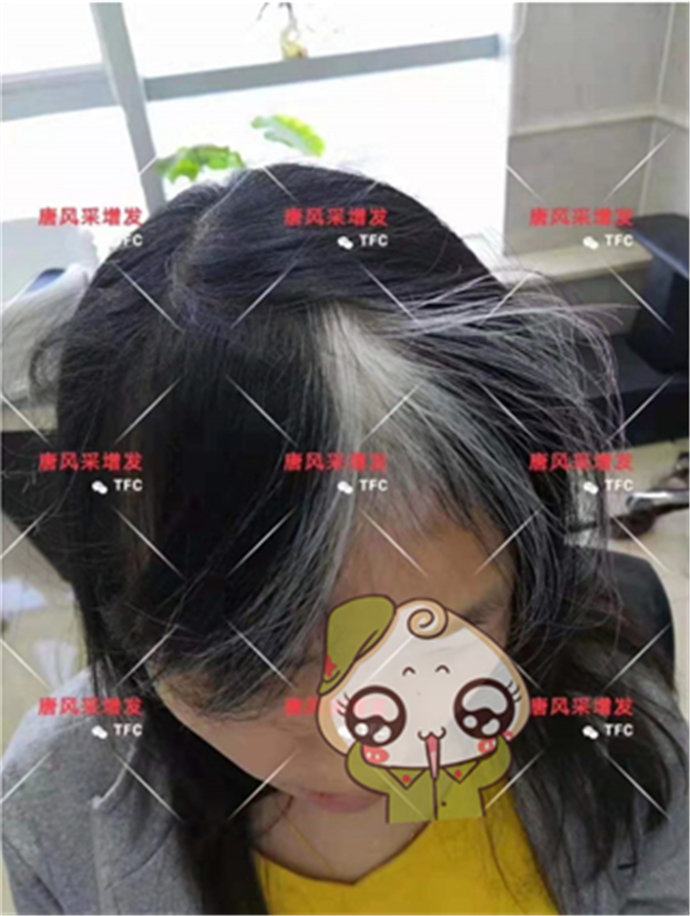 蓋白發(fā)假發(fā) \